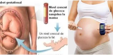 Totul despre diabetul gestational. Care sunt simptomele si ce tratament este recomandat | Demamici.ro