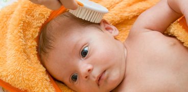 Cum apare crusta de lapte si cum se trateaza. Dermatita seboreica infantila | Demamici.ro