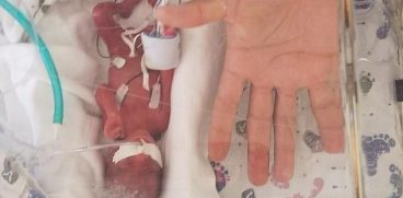 Bebelus nascut la 23 de saptamani lupta pentru viata. Micutul a avut la nastere 368 grame | Demamici.ro