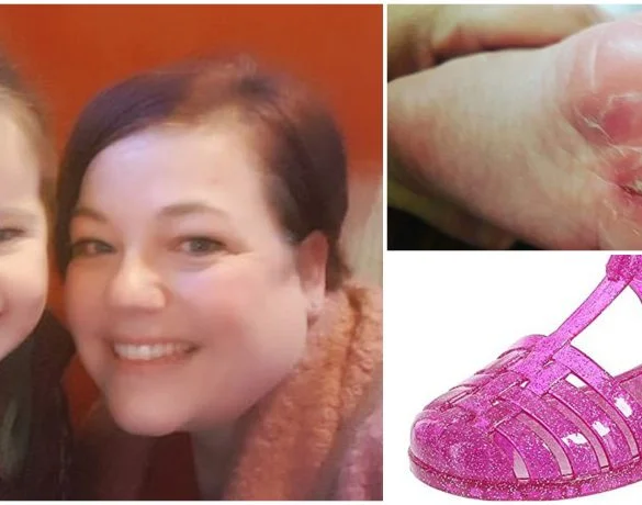 O fetiță de trei ani s-a ales cu răni groaznice la picioare după ce a stat încălțată timp de 10 minute cu sandale de cauciuc | Demamici.ro