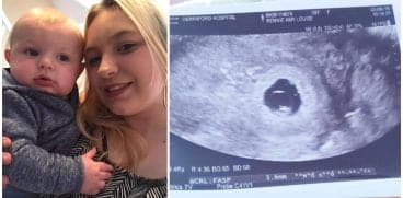 A pierdut sarcina după ce a stat 12 ore la Urgențe: „Nu vreau ca nimeni să treacă prin ce am trecut eu în acea zi” | Demamici.ro