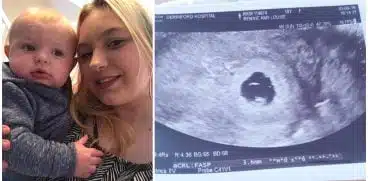 A pierdut sarcina după ce a stat 12 ore la Urgențe: „Nu vreau ca nimeni să treacă prin ce am trecut eu în acea zi” | Demamici.ro