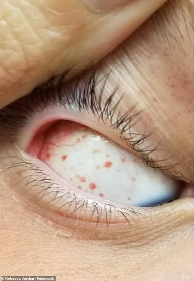 Un baietel a ajuns la Urgente dupa ce s-a invartit in leagan, cu capul in jos | Demamici.ro