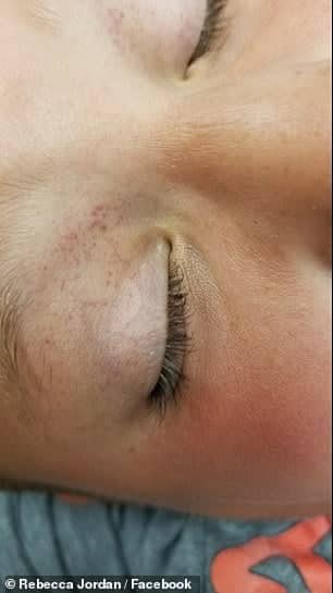 Un baietel a ajuns la Urgente dupa ce s-a invartit in leagan, cu capul in jos | Demamici.ro