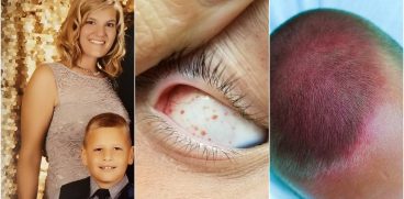 Un baietel a ajuns la Urgente dupa ce s-a invartit in leagan, cu capul pe spate | Demamici.ro