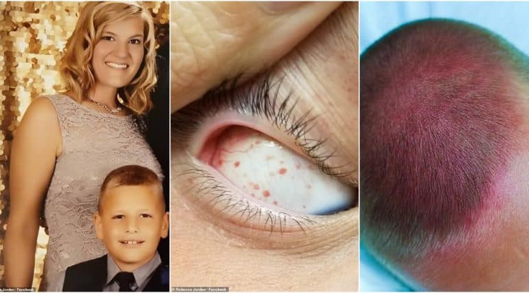 Un baietel a ajuns la Urgente dupa ce s-a invartit in leagan, cu capul in jos | Demamici.ro