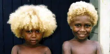 Copiii cu pielea neagra si parul blond natural. Miracolul determinat de o gena mutant | Demamici.ro