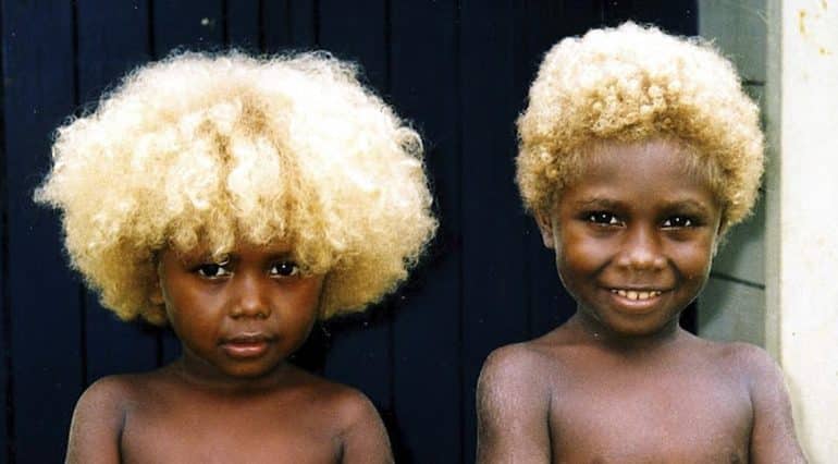 Copii cu pielea neagra si parul blond natural