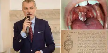 Dr. Mihai Craiu, despre „rosul in gat”! Cand e cazul sa mergeti la spital | Demamici.ro