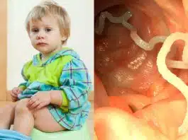 Viermisori intestinali. Primele simptome si cum sa iti feresti copilul de infestare | Demamici.ro