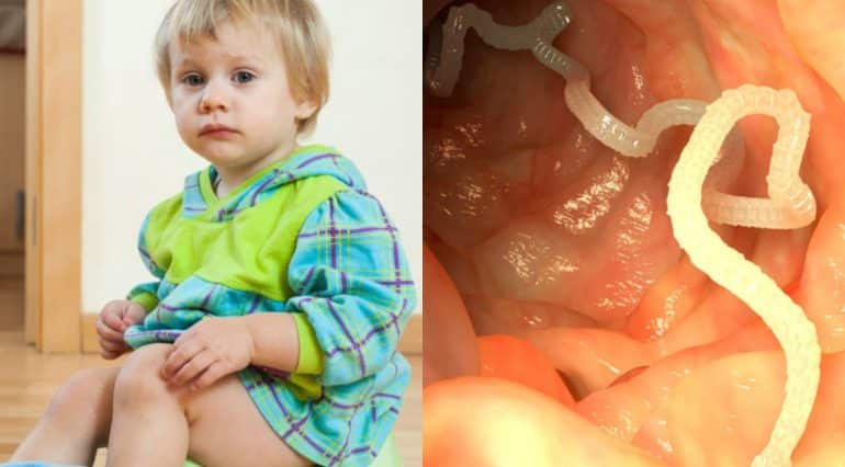 Viermi intestinali la bebelusi si copii