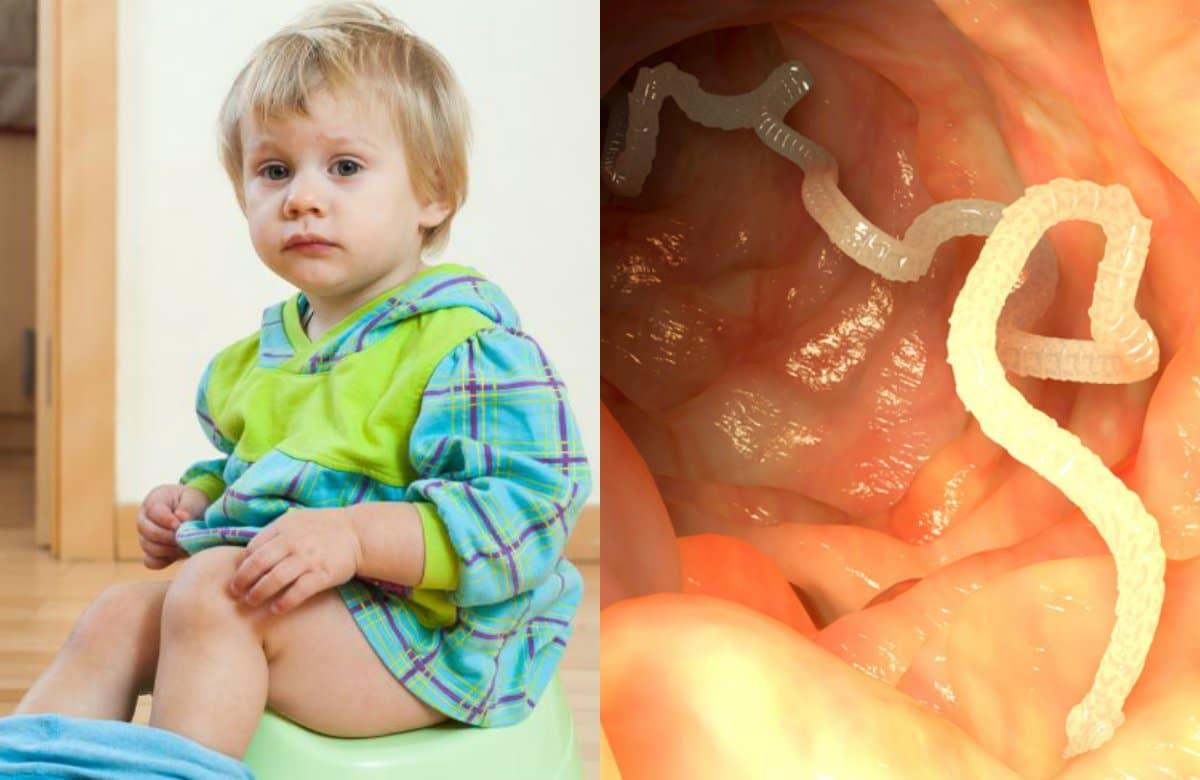 simptome viermisori copii 2 ani)