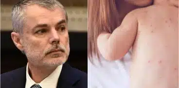 Peste 70 de copii, morti din cauza rujeolei! Dr. Mihai Craiu: „Adresati-va medicului de familie daca copilul nu are 2 doze de ROR!” | Demamici.ro