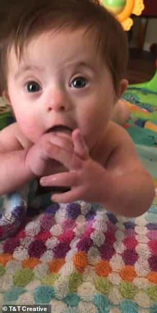 Fetita cu sindromul Down, adoptata. La 8 luni, si-a topit noua mama cu zambetul asta VIDEO | Demamici.ro