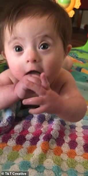 Fetita cu sindromul Down, adoptata. La 8 luni, si-a topit noua mama cu zambetul asta VIDEO | Demamici.ro