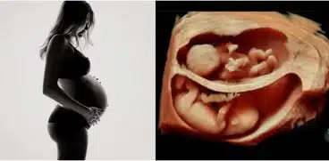 Sarcina gemelara. Curajul de a aduce pe lume nu una, ci doua vieti | Demamici.ro