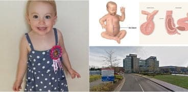 Ocluzie intestinala, confundata cu gastroenterita. Asa a murit o fetita de 2 anisori | Demamici.ro