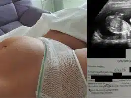 Fumatul in sarcina. Elena a nascut un copil mort la 28 de saptamani | Demamici.ro