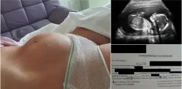 Fumatul in sarcina. Elena a nascut un copil mort la 28 de saptamani | Demamici.ro