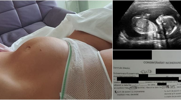 Fumatul in sarcina. Elena a nascut un copil mort la 28 de saptamani | Demamici.ro