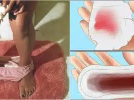 Sangerarea de implantare. Cum o recunosti | Demamici.ro