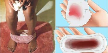 Sangerarea de implantare. Cum o recunosti | Demamici.ro