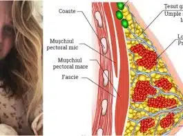 Afectiuni ale sanilor in alaptare. Dermatita atopica a mamelonului, perla de lapte si infectia cu candida | Demamici.ro