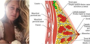 Afectiuni ale sanilor in alaptare. Dermatita atopica a mamelonului, perla de lapte si infectia cu candida | Demamici.ro