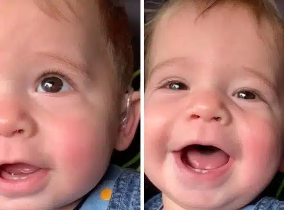 Bebelus nascut surd aude pentru prima data vocea mamei sale VIDEO | Demamici.ro