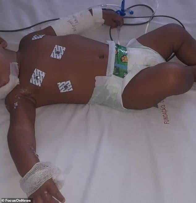 Bebelus electrocutat dupa ce a bagat incarcatorul de la telefon in gura! Fetita de 6 luni a suferit arsuri grave pe fata si maini | Demamici.ro