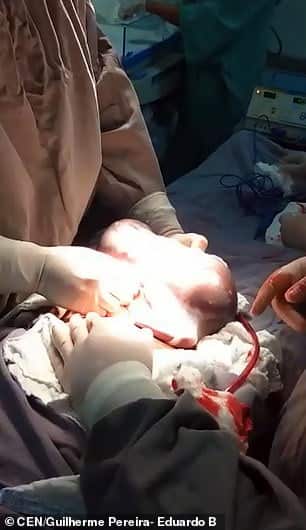 Un bebelus s-a nascut in sacul amniotic. Caz de 1 la 80.000 de nasteri VIDEO | Demamici.ro
