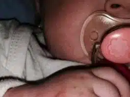 Bebelus de 5 luni, plin de rani in spital dupa ce a facut alergie la leucoplast | Demamici.ro