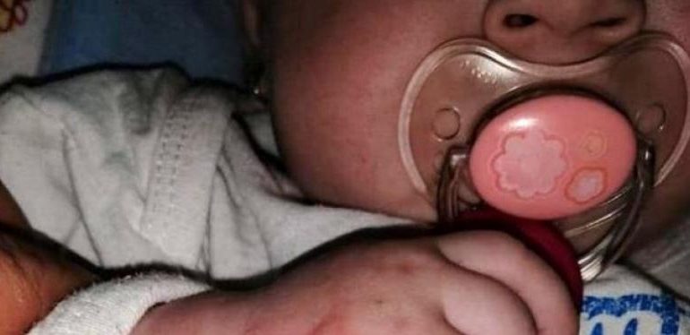 Bebelus de 5 luni, plin de rani in spital dupa ce a facut alergie la leucoplast | Demamici.ro