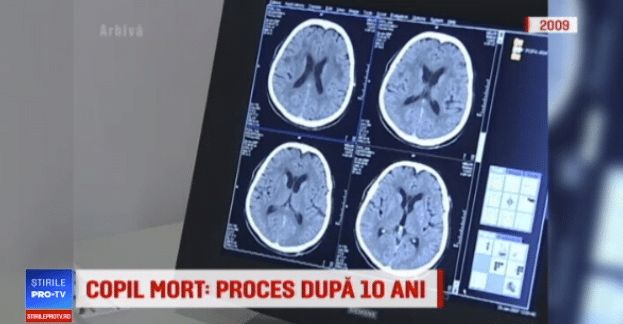 Un baietel de 3 ani a murit dupa o anestezie intr-o clinica de top din Bucuresti | Demamici.ro