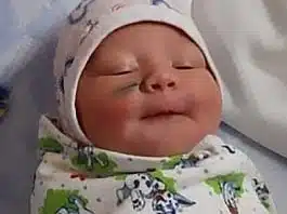 O fetita nou-nascuta s-a ales cu o cicatrice dupa ce doctorii i-au taiat accidental fata in timpul cezarienei | Demamici.ro