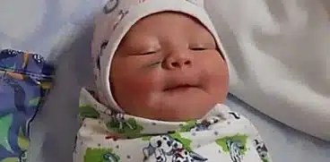 O fetita nou-nascuta s-a ales cu o cicatrice dupa ce doctorii i-au taiat accidental fata in timpul cezarienei | Demamici.ro