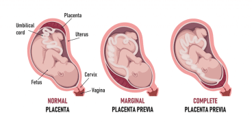 Placenta: rolul ei in sarcina si afectiuni care pot aparea | Demamici.ro
