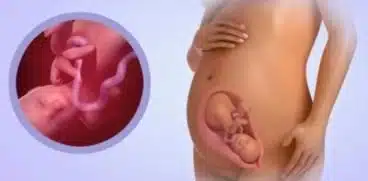 Sarcina pe saptamani: saptamana 26 de sarcina | Demamici.ro