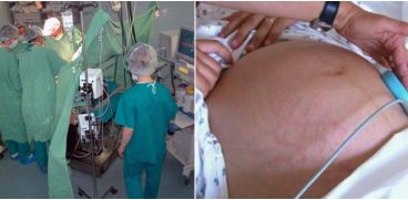 Gravida in luna a opta din Bacau, cu tumora cervicala, salvata la timp impreuna cu bebelusul | Demamici.ro