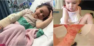 Fetita de 5 ani, alergica la soare. Micuta nu poate iesi din casa fara un costum special | Demamici.ro