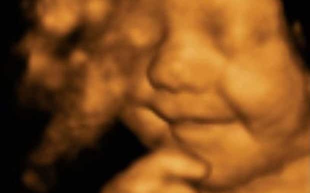 10 lucruri uimitoare pe care bebelusii le fac in uterul mamei