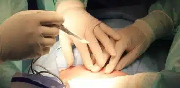 Gravida care a intrat in contact cu o persoana suspecta de coronavirus, operata de medici fara echipament special de protectie. Declaratiile unui medic | Demamici.ro