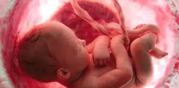 Lichidul amniotic. Ce se intampla cand lichidul e in exces, dar cand e prea putin? | Demamici.ro