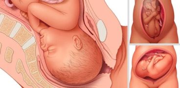Pozitiile copilului la nastere | Demamici.ro