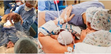 Moasa la propria nastere. Si-a scos copilul din uter, in timpul operatiei de cezariana VIDEO | Demamici.ro