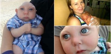 Baietelul care s-a nascut fara o parte din creier a murit la 5 ani | Demamici.ro