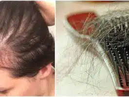 Căderea părului după naștere. Remedii naturale | Demamici.ro