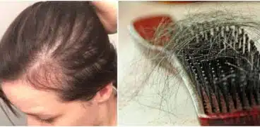 Căderea părului după naștere. Remedii naturale | Demamici.ro