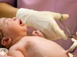 Beneficiile tăierii întârziate a cordonului ombilical. Recomandările OMS | Demamici.ro