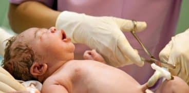 Beneficiile tăierii întârziate a cordonului ombilical. Recomandările OMS | Demamici.ro